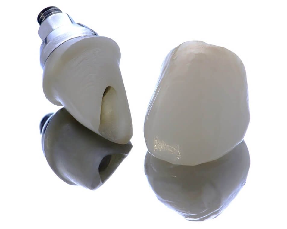 Одиночная коронка и абатмент из диоксида циркония